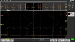 Software Power Measurement and Analysis